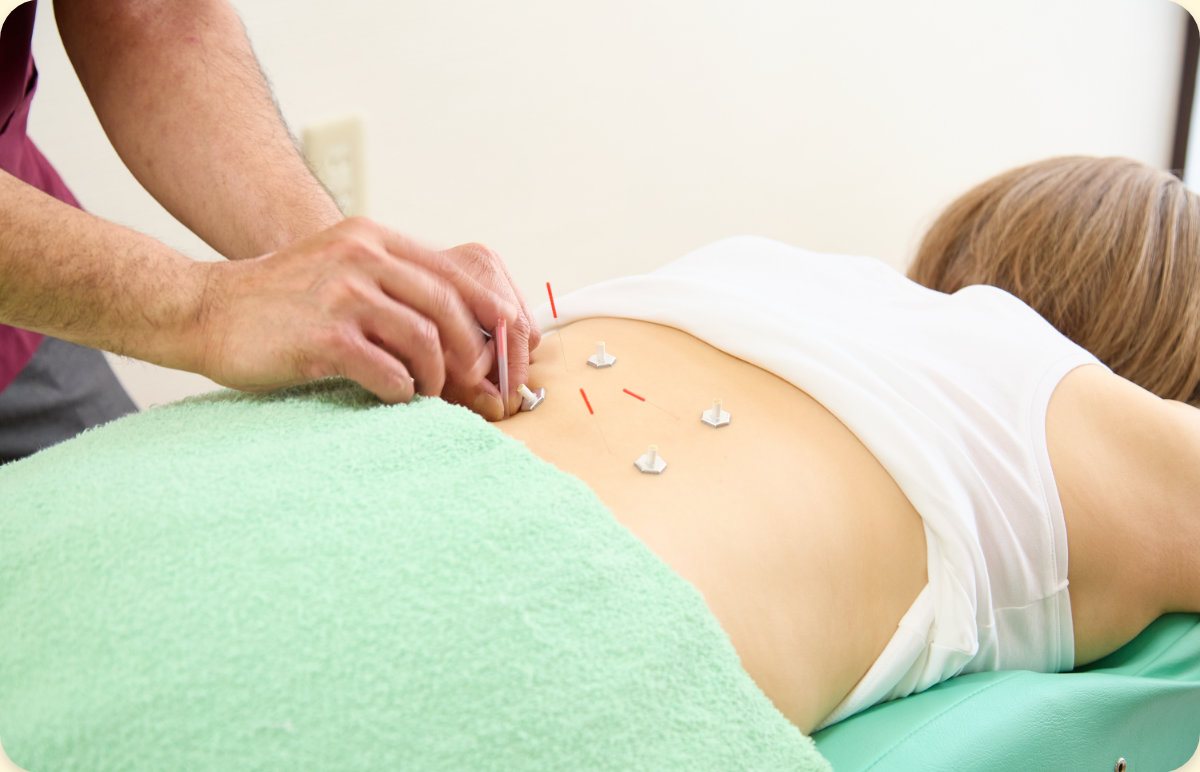 益気導鍼灸マッサージ院 鍼灸治療